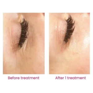 RETIX.C PROFESSIONAL EYE+ nano maska